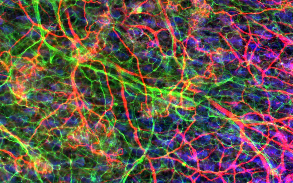Les nerfs et le système vasculaire se côtoient dans cette image, montrant le réseau neurovasculaire de la peau d'une souris. 