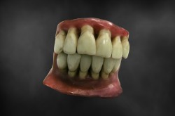 A wax model of a set of yellowed and unsightly teeth seem to be suspended in the air, set against a black background. 